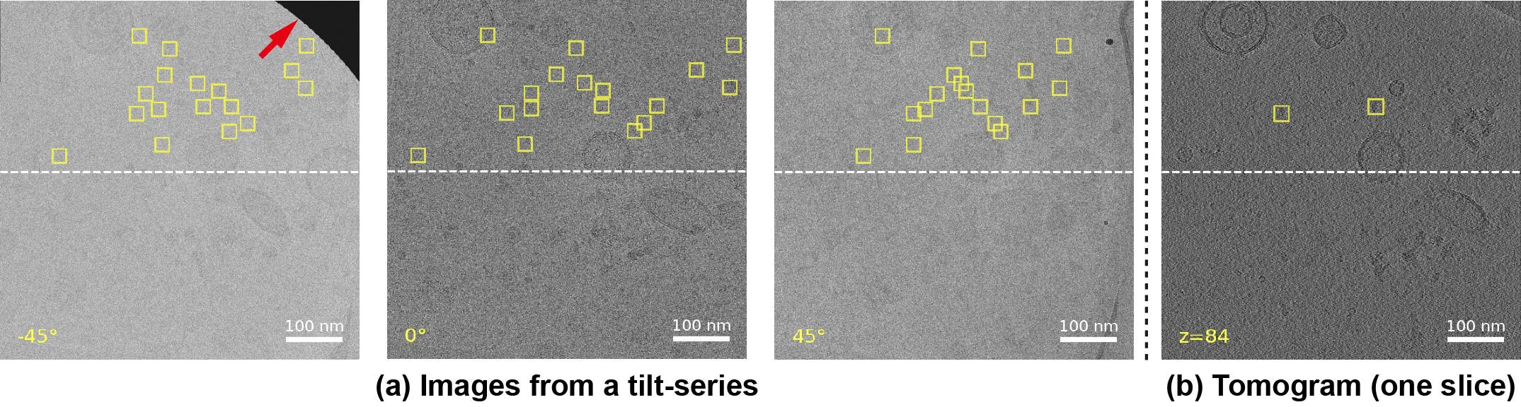 Three tilt images at −45°, 0° and 45° with thyroglobulin particles boxed, next to one tomogram slice.