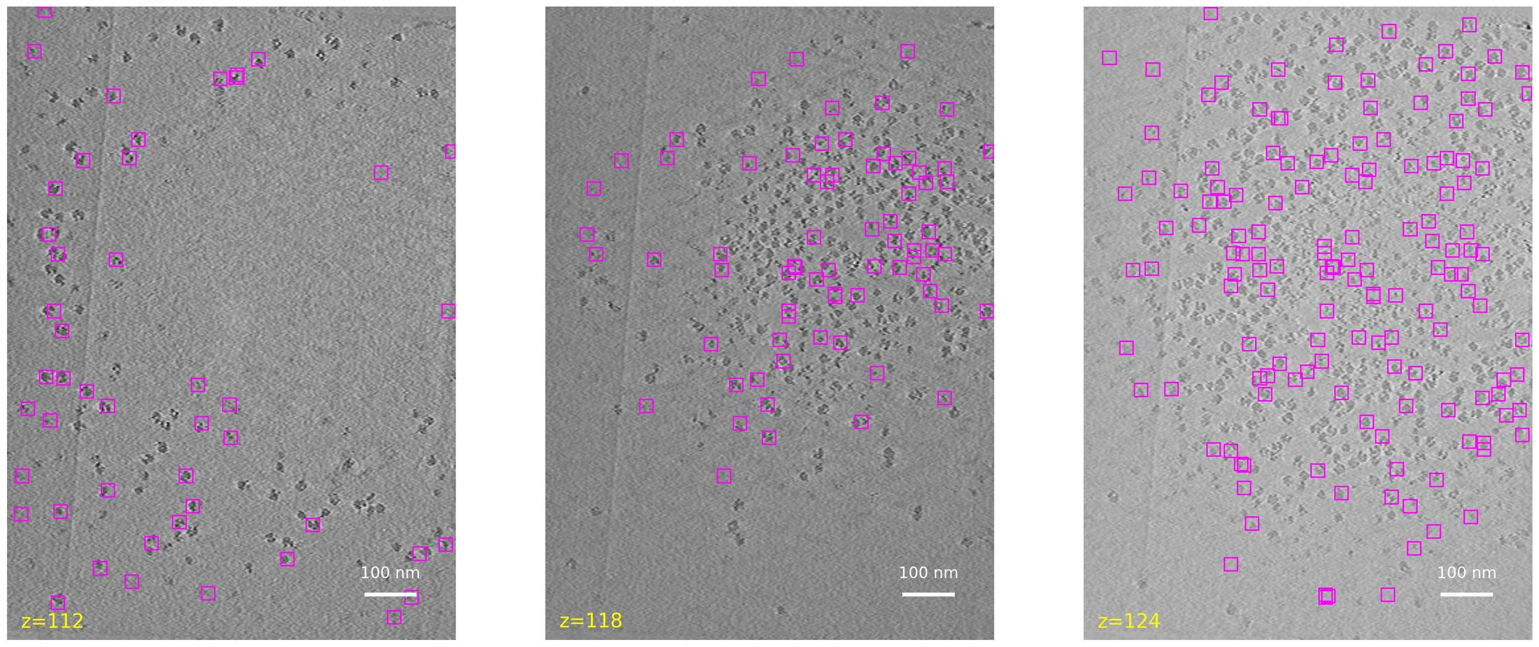 ProPicker detections on tomogram slices